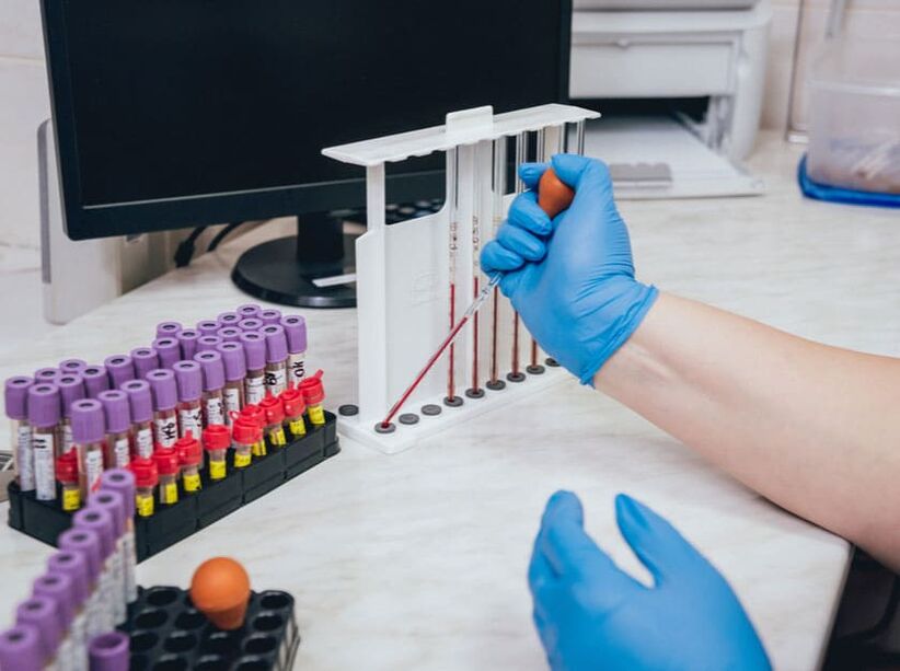 tomar azucre no sangue despois de beber alcohol