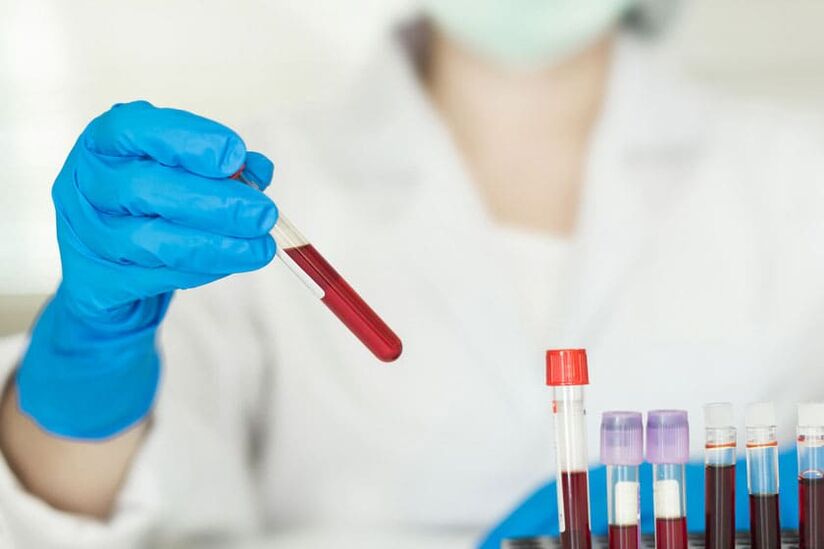 É posible beber alcohol antes de doar sangue